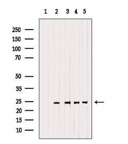 Invitrogen RAB14 Polyclonal Antibody 100 &mu;L; Unconjugated:Antibodies,