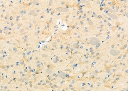 Invitrogen RBBP9 Polyclonal Antibody 100 &mu;L | Buy Online | Invitrogen&trade; | Fisher Scientific