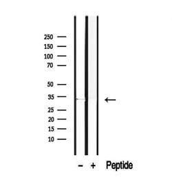 Invitrogen ROGDI Polyclonal Antibody 100 &mu;L | Buy Online | Invitrogen&trade; | Fisher Scientific