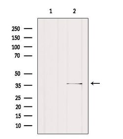 Invitrogen SGCG Polyclonal Antibody 100 &mu;L; Unconjugated:Antibodies,