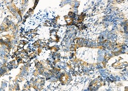 Invitrogen SHMT1 Polyclonal Antibody 100 &mu;L | Buy Online | Invitrogen&trade; | Fisher Scientific