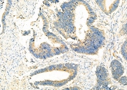 Invitrogen SLC25A46 Polyclonal Antibody 100 &mu;L; Unconjugated:Antibodies,