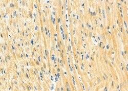 Invitrogen SPAG4L Polyclonal Antibody 100 &mu;L; Unconjugated:Antibodies,