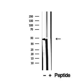 Invitrogen SPAG4L Polyclonal Antibody 100 &mu;L; Unconjugated:Antibodies,