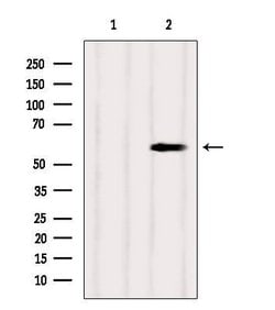 Invitrogen SUOX Polyclonal Antibody 100 &mu;L | Buy Online | Invitrogen&trade; | Fisher Scientific