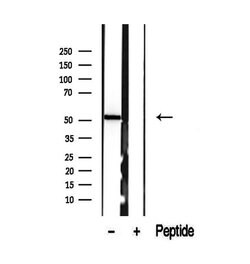 Invitrogen SUOX Polyclonal Antibody 100 &mu;L | Buy Online | Invitrogen&trade; | Fisher Scientific