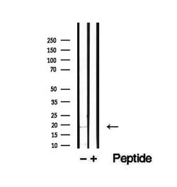 Invitrogen TMEM70 Polyclonal Antibody 100 &mu;L; Unconjugated:Antibodies,