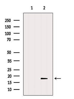 Invitrogen TMEM70 Polyclonal Antibody 100 &mu;L; Unconjugated:Antibodies,