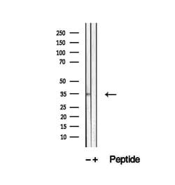 Invitrogen UFD1L Polyclonal Antibody 100 &mu;L; Unconjugated:Antibodies,