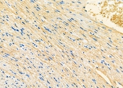 Invitrogen VDAC3 Polyclonal Antibody 100 &mu;L; Unconjugated:Antibodies,