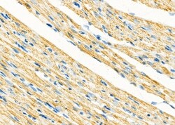 Invitrogen VDAC3 Polyclonal Antibody 100 &mu;L; Unconjugated:Antibodies,