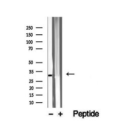 Invitrogen VDAC3 Polyclonal Antibody 100 &mu;L; Unconjugated:Antibodies,