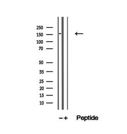Invitrogen ZFYVE16 Polyclonal Antibody 100 &mu;L; Unconjugated:Antibodies,