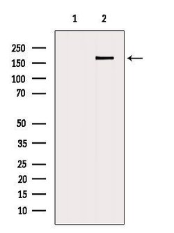 Invitrogen ZFYVE16 Polyclonal Antibody 100 &mu;L; Unconjugated:Antibodies,