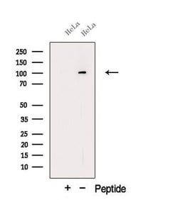 Invitrogen ORP6 Polyclonal Antibody 100 &mu;L; Unconjugated:Antibodies,