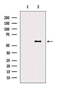 RASSF10 Polyclonal Antibody 100 &mu;L | Buy Online | Thermo Scientific | Fisher Scientific