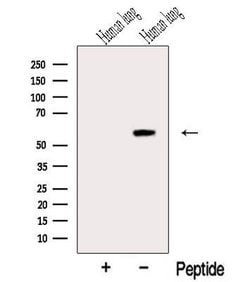 RASSF10 Polyclonal Antibody 100 &mu;L | Buy Online | Thermo Scientific | Fisher Scientific