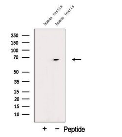 Invitrogen DTX2 Polyclonal Antibody 100 &mu;L; Unconjugated:Antibodies,