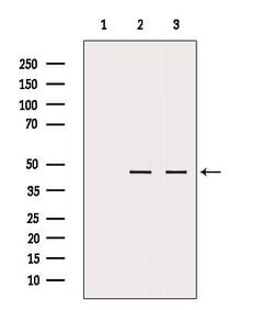 Invitrogen MTCH1 Polyclonal Antibody 100 &mu;L; Unconjugated:Antibodies,