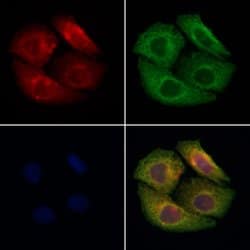 Invitrogen MMP24 Polyclonal Antibody 100 &mu;L; Unconjugated:Antibodies,
