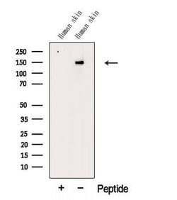 Invitrogen COL5A2 Polyclonal Antibody 100 &mu;L; Unconjugated:Antibodies,