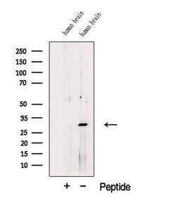 Invitrogen TMEM158 Polyclonal Antibody 100 &mu;L; Unconjugated:Antibodies,