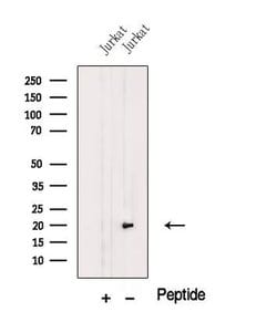Invitrogen MFAP5 Polyclonal Antibody 100 &mu;L; Unconjugated:Antibodies,