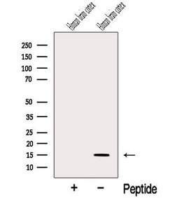 Invitrogen Neuritin Polyclonal Antibody 100 &mu;L; Unconjugated:Antibodies,