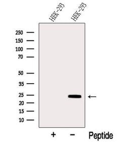 Invitrogen SIKE Polyclonal Antibody 100 &mu;L; Unconjugated:Antibodies,