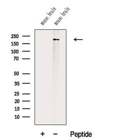 Invitrogen Titin Polyclonal Antibody 100 &mu;L; Unconjugated:Antibodies,