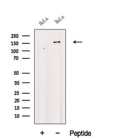 Invitrogen FBXL10 Polyclonal Antibody 100 &mu;L | Buy Online | Invitrogen&trade; | Fisher Scientific