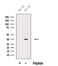 Invitrogen MSI2 Polyclonal Antibody 100 &mu;L; Unconjugated:Antibodies,