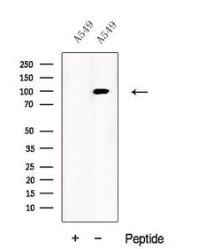 Invitrogen USP5 Polyclonal Antibody 100 &mu;L; Unconjugated:Antibodies,