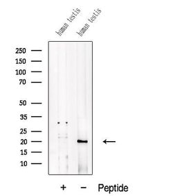 Invitrogen ADI1 Polyclonal Antibody 100 &mu;L; Unconjugated:Antibodies,