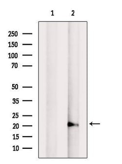 Invitrogen ADI1 Polyclonal Antibody 100 &mu;L; Unconjugated:Antibodies,