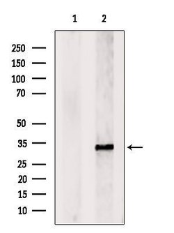 Invitrogen V-ATPase E1 Polyclonal Antibody 100 &mu;L | Buy Online | Invitrogen&trade; | Fisher Scientific