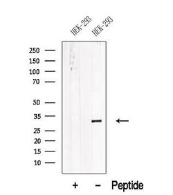 Invitrogen V-ATPase E1 Polyclonal Antibody 100 &mu;L | Buy Online | Invitrogen&trade; | Fisher Scientific