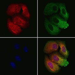 Invitrogen BBS9 Polyclonal Antibody 100 &mu;L; Unconjugated:Antibodies,