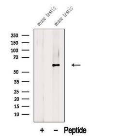 Invitrogen BBS9 Polyclonal Antibody 100 &mu;L; Unconjugated:Antibodies,