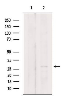 TIMM21 Polyclonal Antibody:Antibodies, Polyclonal