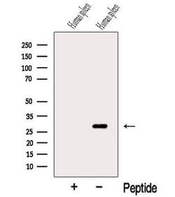 TIMM21 Polyclonal Antibody:Antibodies, Polyclonal