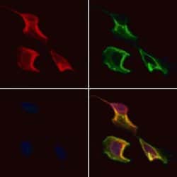 Invitrogen CCDC120 Polyclonal Antibody 100 &mu;L; Unconjugated:Antibodies,