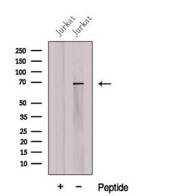 Invitrogen CCDC120 Polyclonal Antibody 100 &mu;L; Unconjugated:Antibodies,