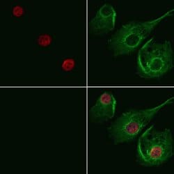 Invitrogen CNOT3 Polyclonal Antibody 100 &mu;L; Unconjugated:Antibodies,