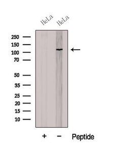 Invitrogen CNOT3 Polyclonal Antibody 100 &mu;L; Unconjugated:Antibodies,
