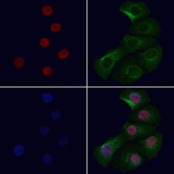 COMMD5 Polyclonal Antibody:Antibodies, Polyclonal