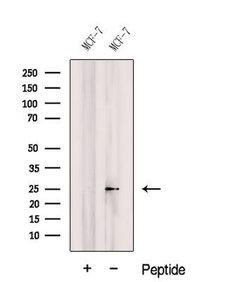 COMMD5 Polyclonal Antibody:Antibodies, Polyclonal