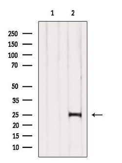 COMMD5 Polyclonal Antibody:Antibodies, Polyclonal