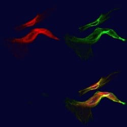 Invitrogen NG2 Polyclonal Antibody 100 &mu;L | Buy Online | Invitrogen&trade; | Fisher Scientific