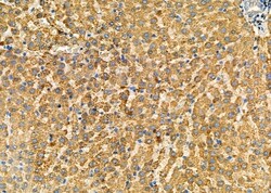 Invitrogen NG2 Polyclonal Antibody 100 &mu;L | Buy Online | Invitrogen&trade; | Fisher Scientific